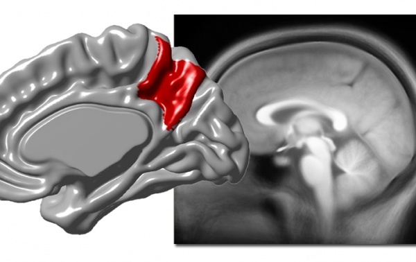 Se demuestra que  diferencias entre los individuos están asociadas a variaciones de corteza cerebral